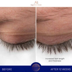 AUGUSTINUS BADER | The Eyebrow And Lash Enhancing Serum 8 AUGUSTINUS BADER | The Eyebrow And Lash Enhancing Serum -Sturm Beauty Shop 5060552906118 Before After2 jpg